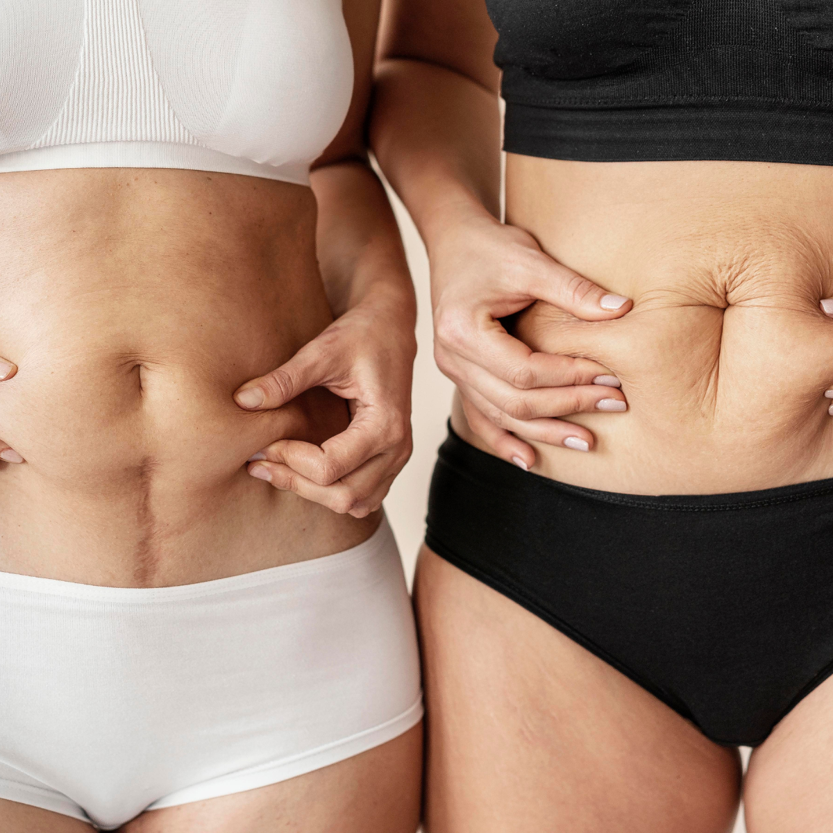 Cómo elegir ropa interior cuando tu cuerpo cambia: peso, hormonas y diferentes etapas de la vida